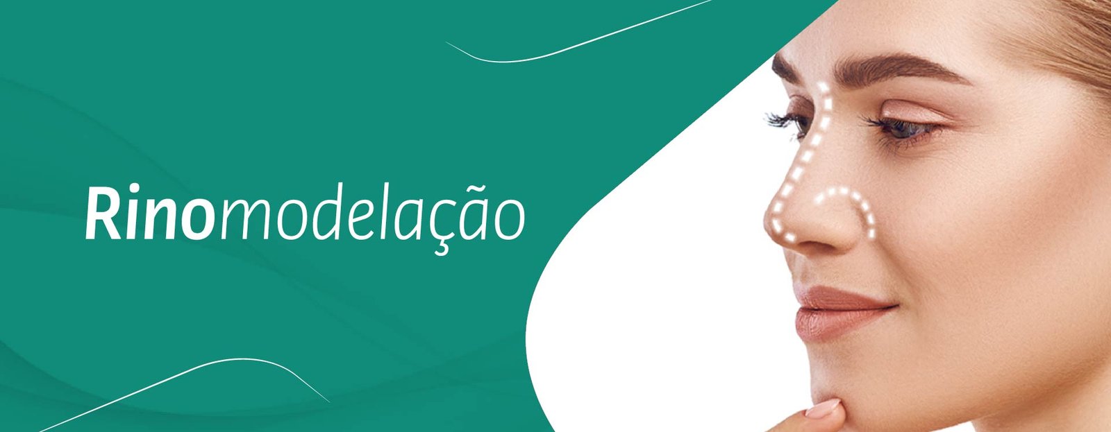 Rinomodelação